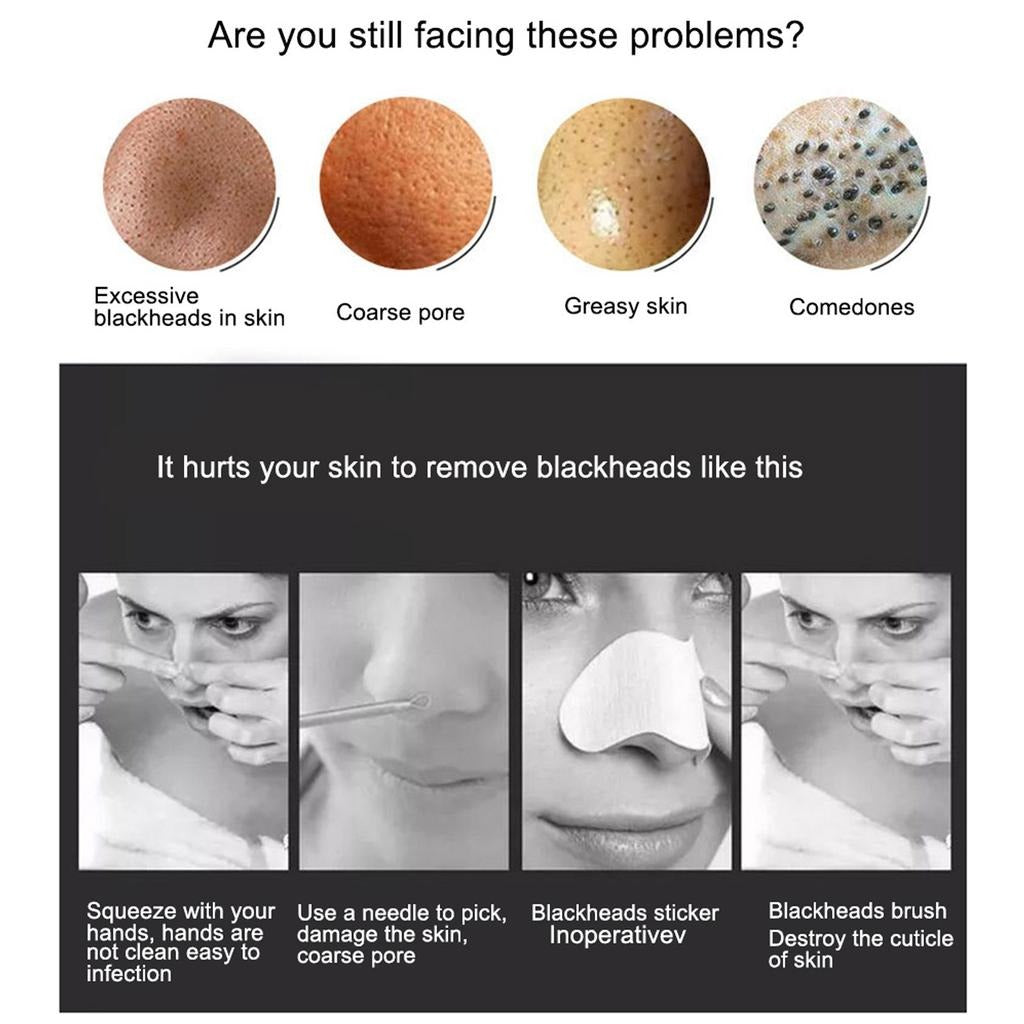 5-in-1 Facial Pore Cleaner – Electric Vacuum for Blackhead, Acne & Oil Removal